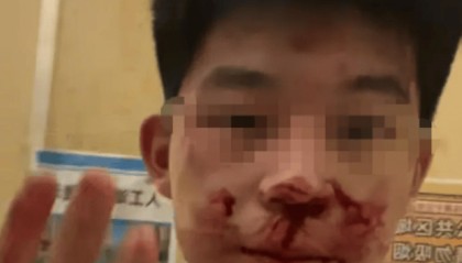 “山西运城17岁男生被人冒充警察骗出家门殴打”案新进展：3人涉嫌寻衅滋事，已移送审查起诉