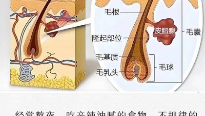 头屑比较多用什么洗发水??无屑社交货币