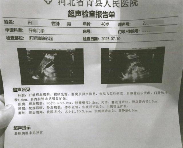 河北一男子意外发现胆囊被“切除” “我从没做过胆囊手术，怎么就有了手术记录？”