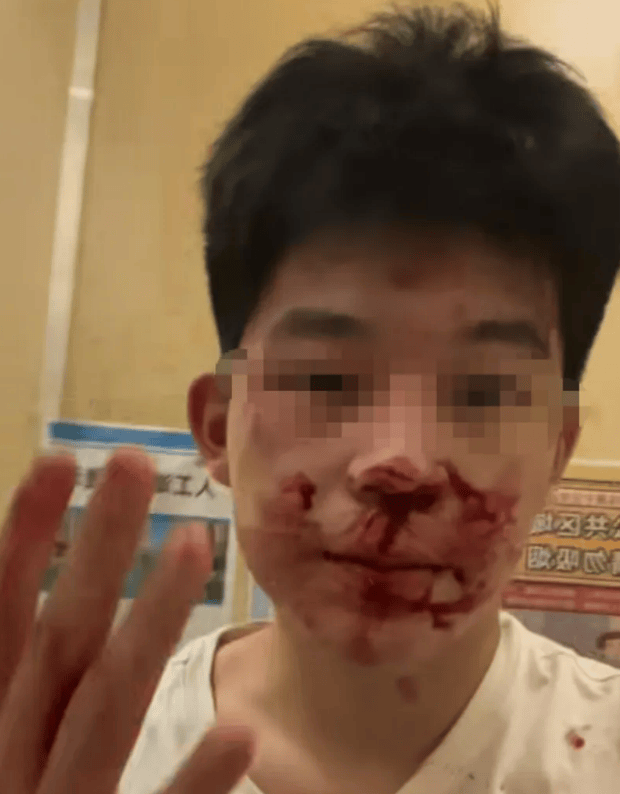 “山西运城17岁男生被人冒充警察骗出家门殴打”案新进展：3人涉嫌寻衅滋事，已移送审查起诉